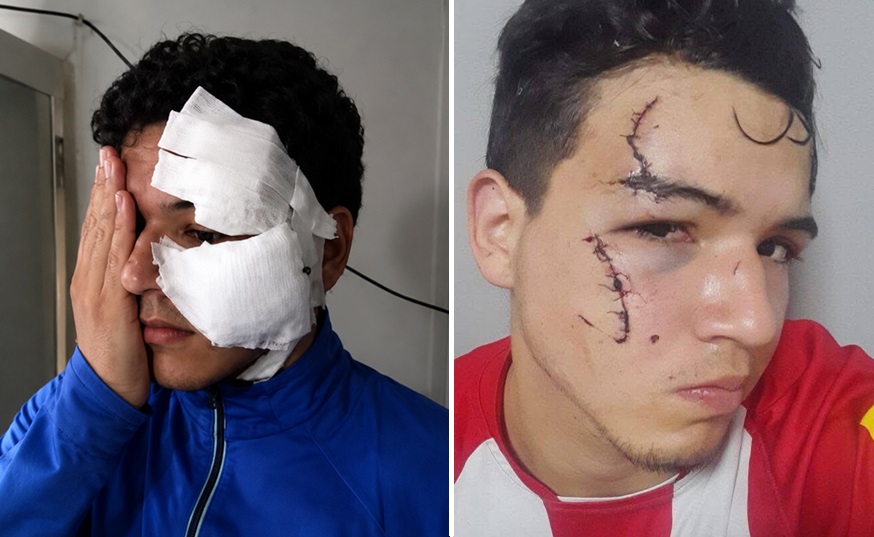Delincuentes con tobillera electrónica hirieron a un joven durante un violento intento de robo en Tafí Viejo